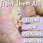 Himalayan Eczema Soap - Simplicity Care Cosmetics