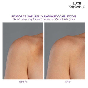 Luxe Organix Retinol Gluta Lotion